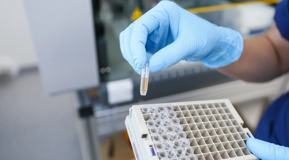 Bioanalyytikko pitelee pieniä näyteputkia telineessä. 