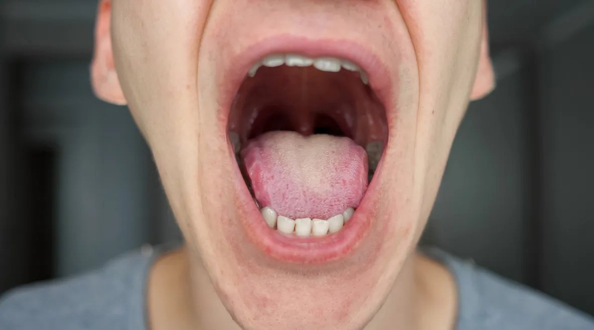 Mies on avannut suunsa apposelleen ja hampaat näkyvät.