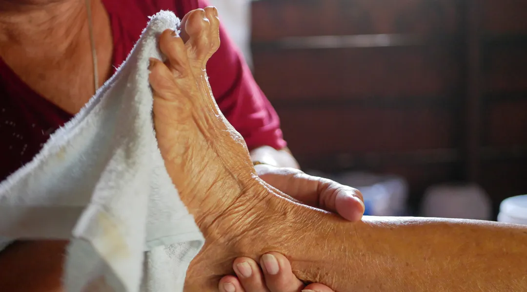 Hoitaja kuivaa vanhuksen jalkaa pyyhkeellä.