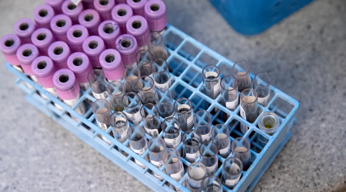 Koko pohjoisen Suomen laboratoriopalveluista vastaava NordLab hyvinvointiyhtymä aloittaa yt-neuvottelut. Verinäyteputkiloita telineessä.