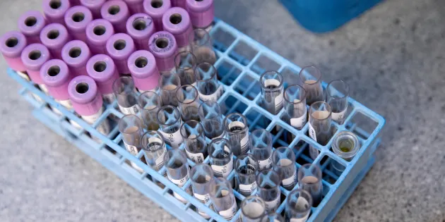 Koko pohjoisen Suomen laboratoriopalveluista vastaava NordLab hyvinvointiyhtymä aloittaa yt-neuvottelut. Verinäyteputkiloita telineessä.