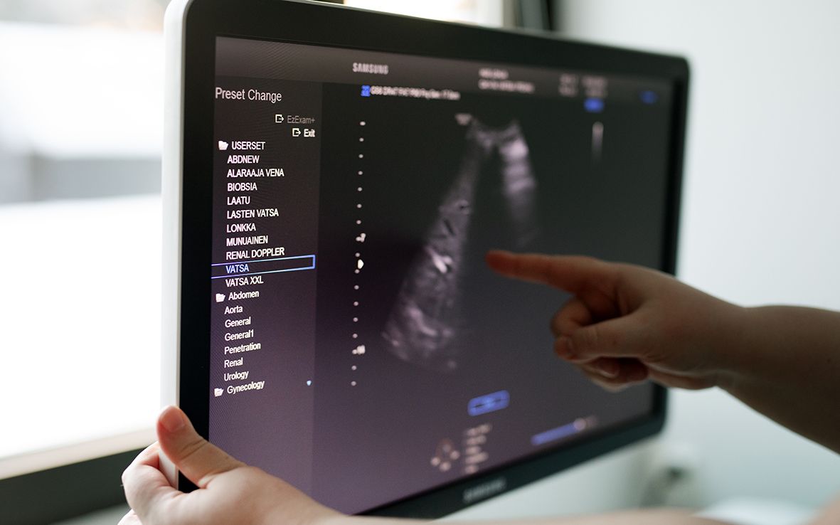 Kuvassa on tietokoneruudulla maksahoitajan käyttämä elastografia-tutkimukseen liittyvä kuva.