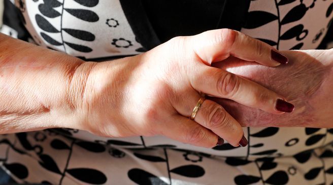 Arja Ahtaanluoman kädet. Vihkisormus näkyy sormessa.